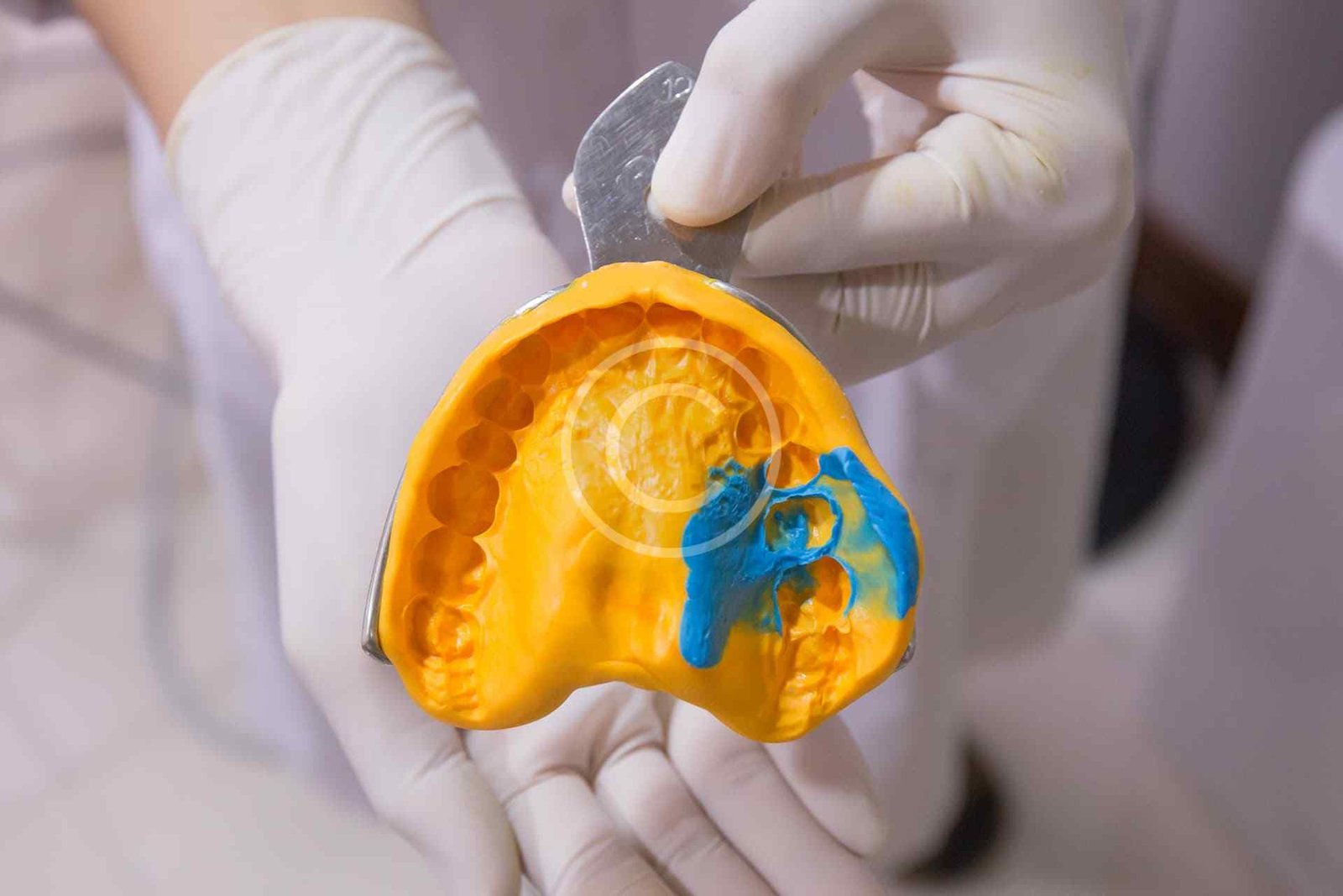 Crowns, Bridges, Dentures