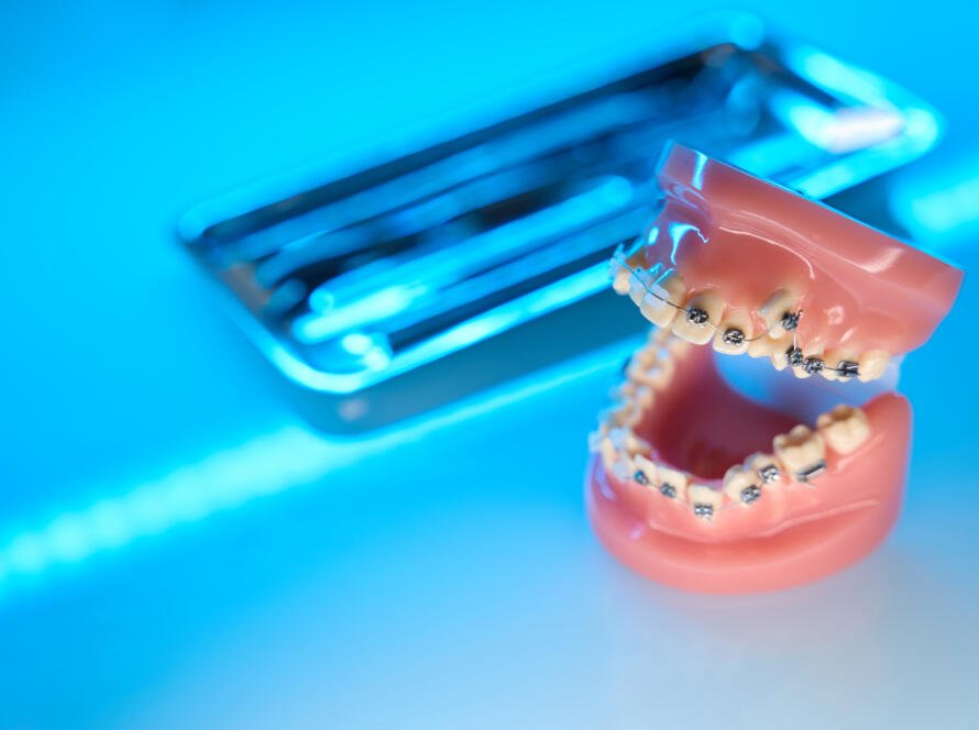 dental services in Katy TX