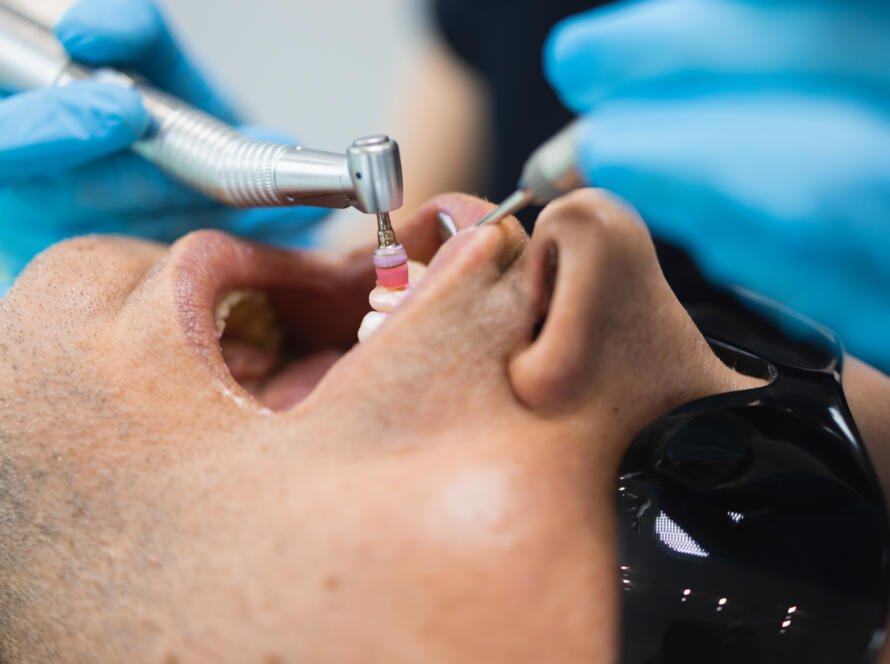 Braces vs Invisalign in Katy TX