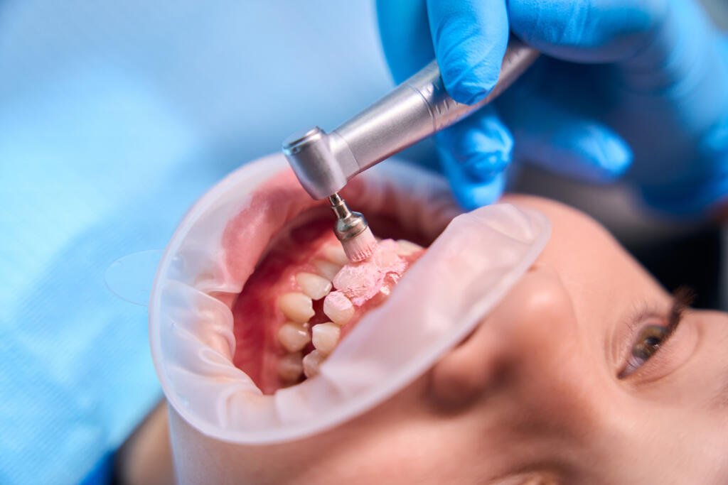 gum disease treatment Katy TX