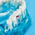Braces vs Invisalign: Which Is Right for Your Smile in Katy, TX?