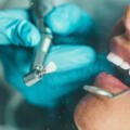 Signs You Need a Deep Cleaning, Not a Regular Cleaning — Katy, TX Dentist Explains