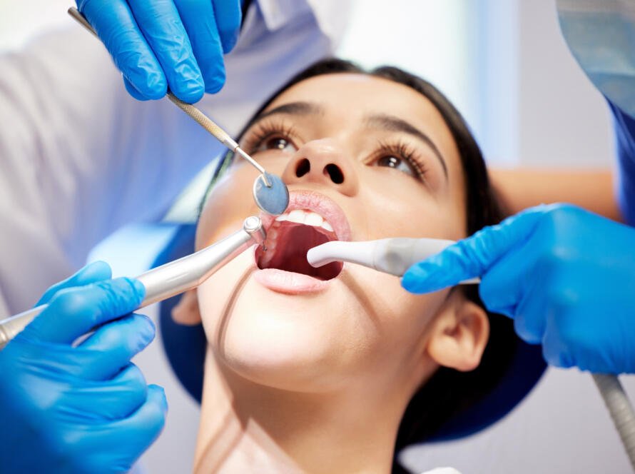 Teeth Whitening Special in Katy TX