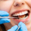 How to Maintain Teeth Whitening Katy TX