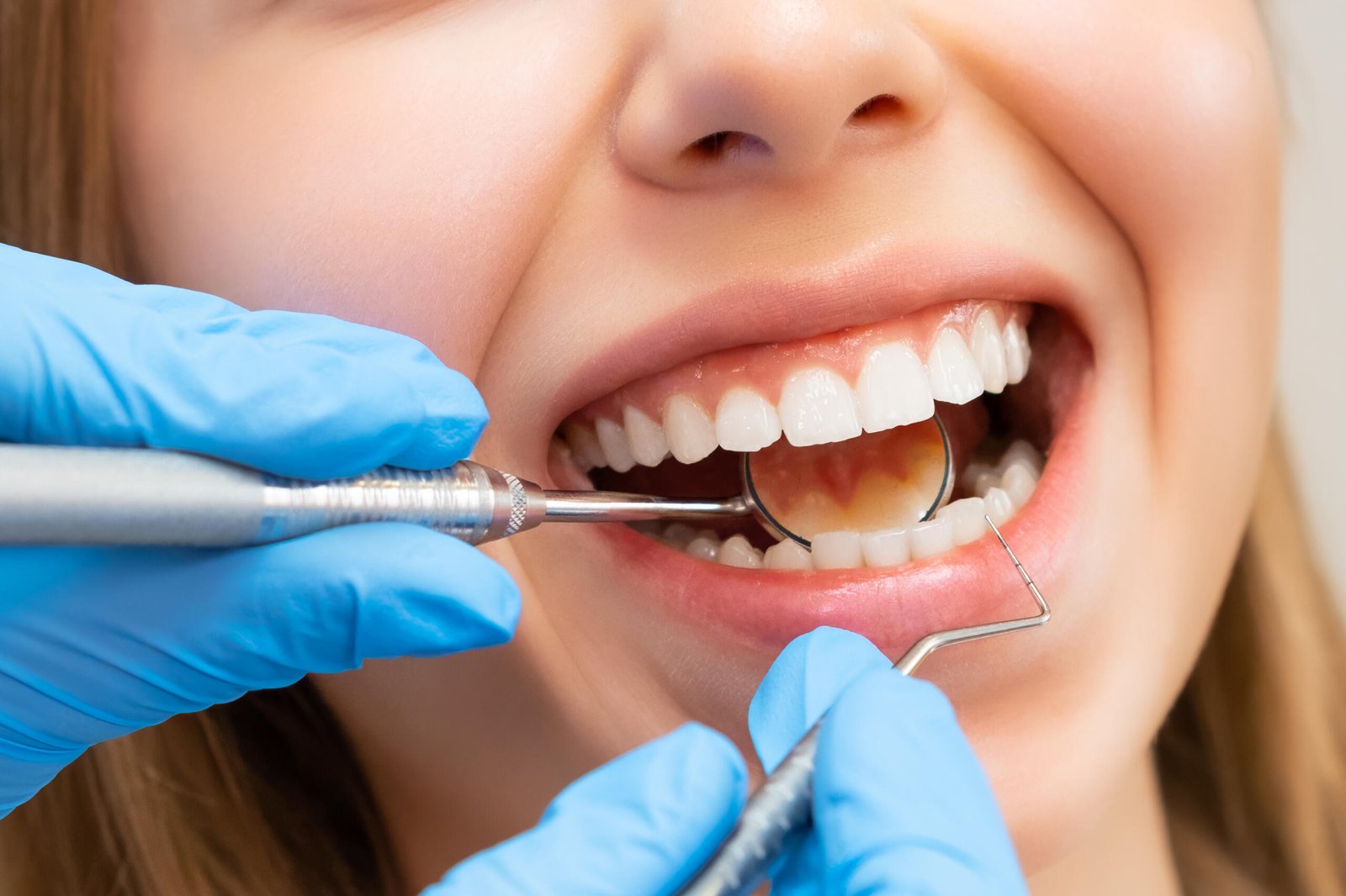 How to Maintain Teeth Whitening Katy TX