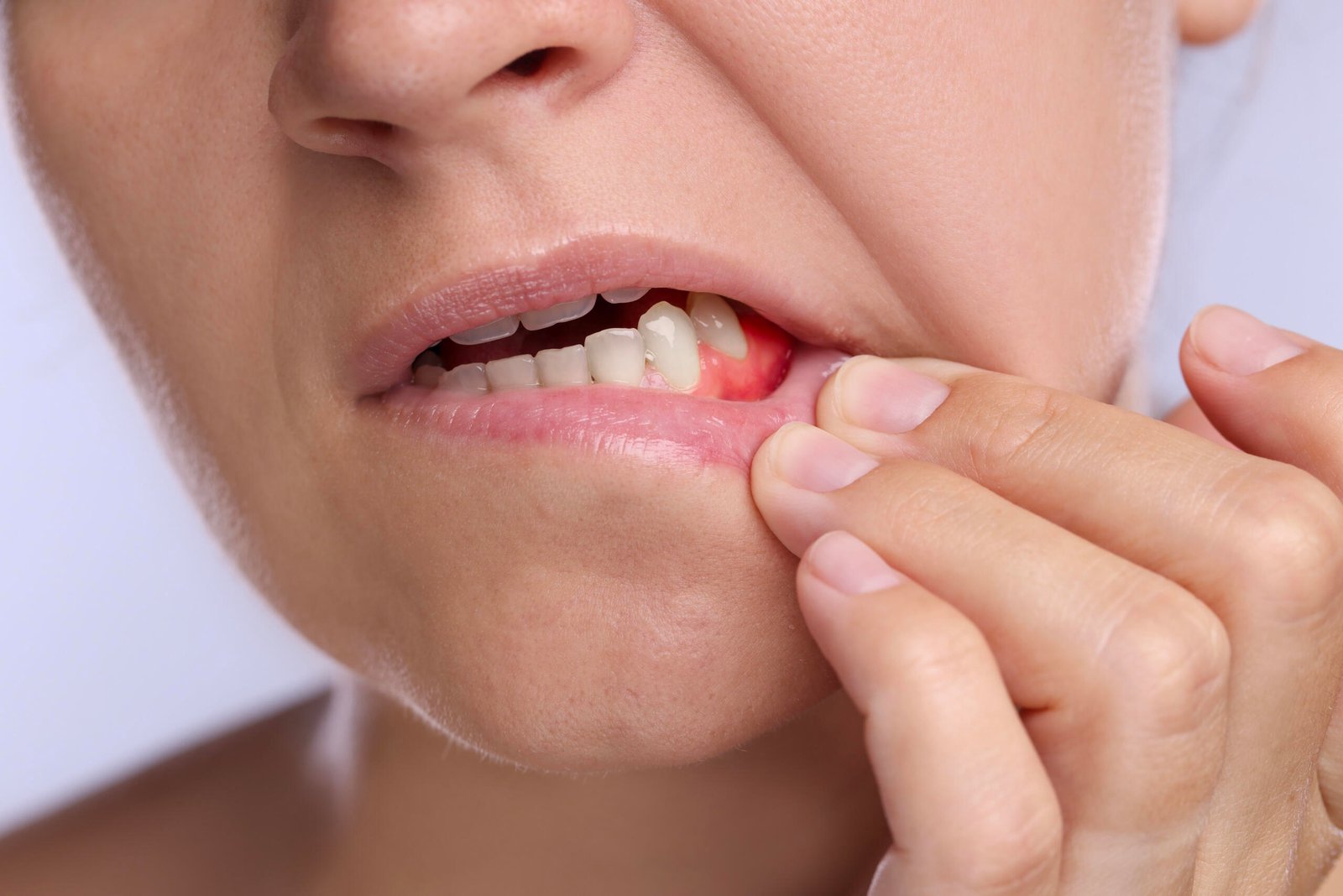 gum disease treatment Katy TX