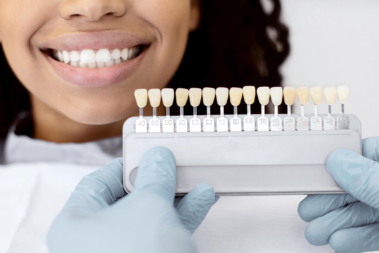 dental crowns in Katy TX